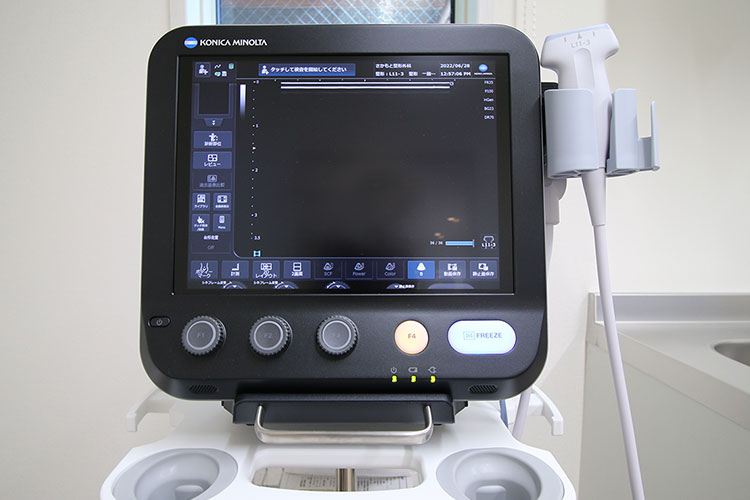 コニカミノルタ超音波診断装置